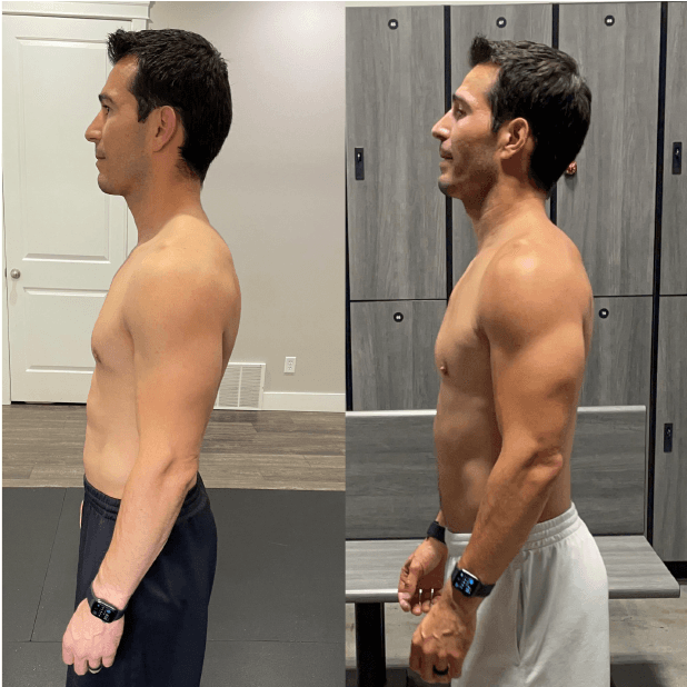 Rafael Chavez side before and after