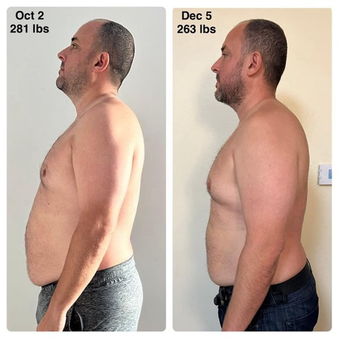 Chris McInally before and after side progress comparison